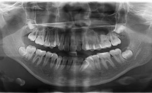 nhakhoaocare_khamtongquat006