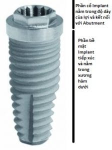 Cau-truc-cua-Implant-Nha-khoa-10