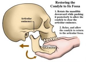Nan-trat-khop-TD-H-4