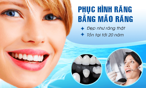 Làm răng sứ ở đâu đẹp