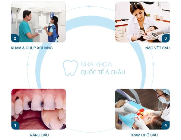 han-rang-sau-nhu-the-nao-de-kff3433333