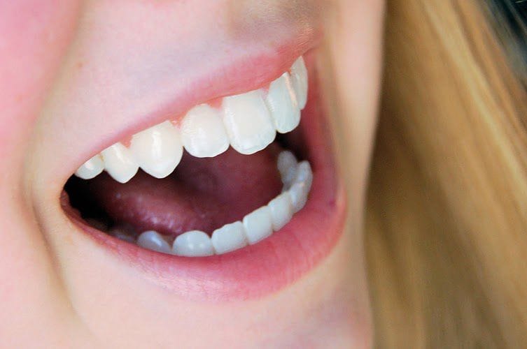 bọc răng sứ giá bao nhiêu tiền