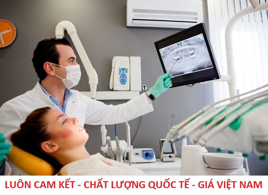 nên làm răng sứ ở đâu