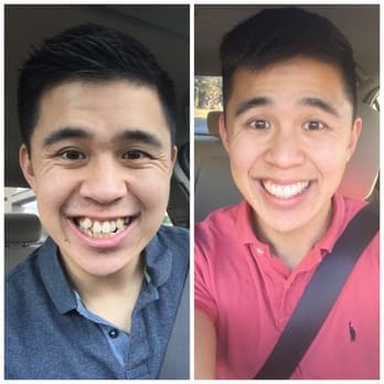 nam-thanhg-niengf-rang-a-chau