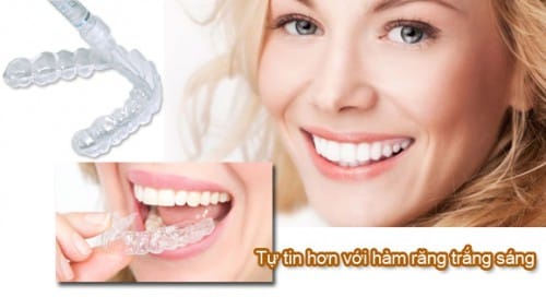 Có thể mua thuốc tẩy trắng răng Opalencence ở đâu