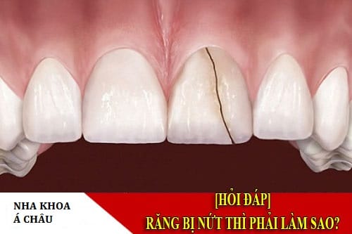 răng sứ bị nứt ngang