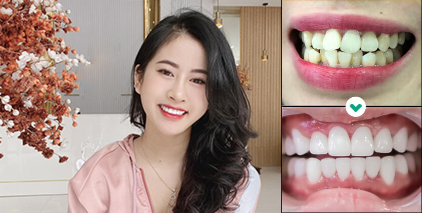 KH. Thùy Dương