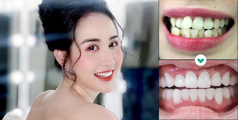 KH. Phương Oanh