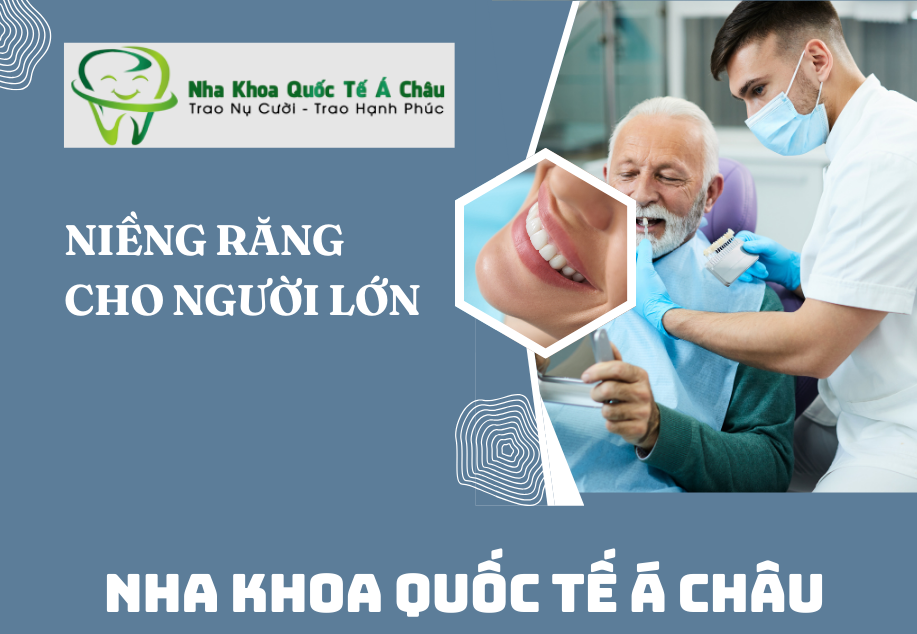 Niềng răng cho người lớn Hà Nội